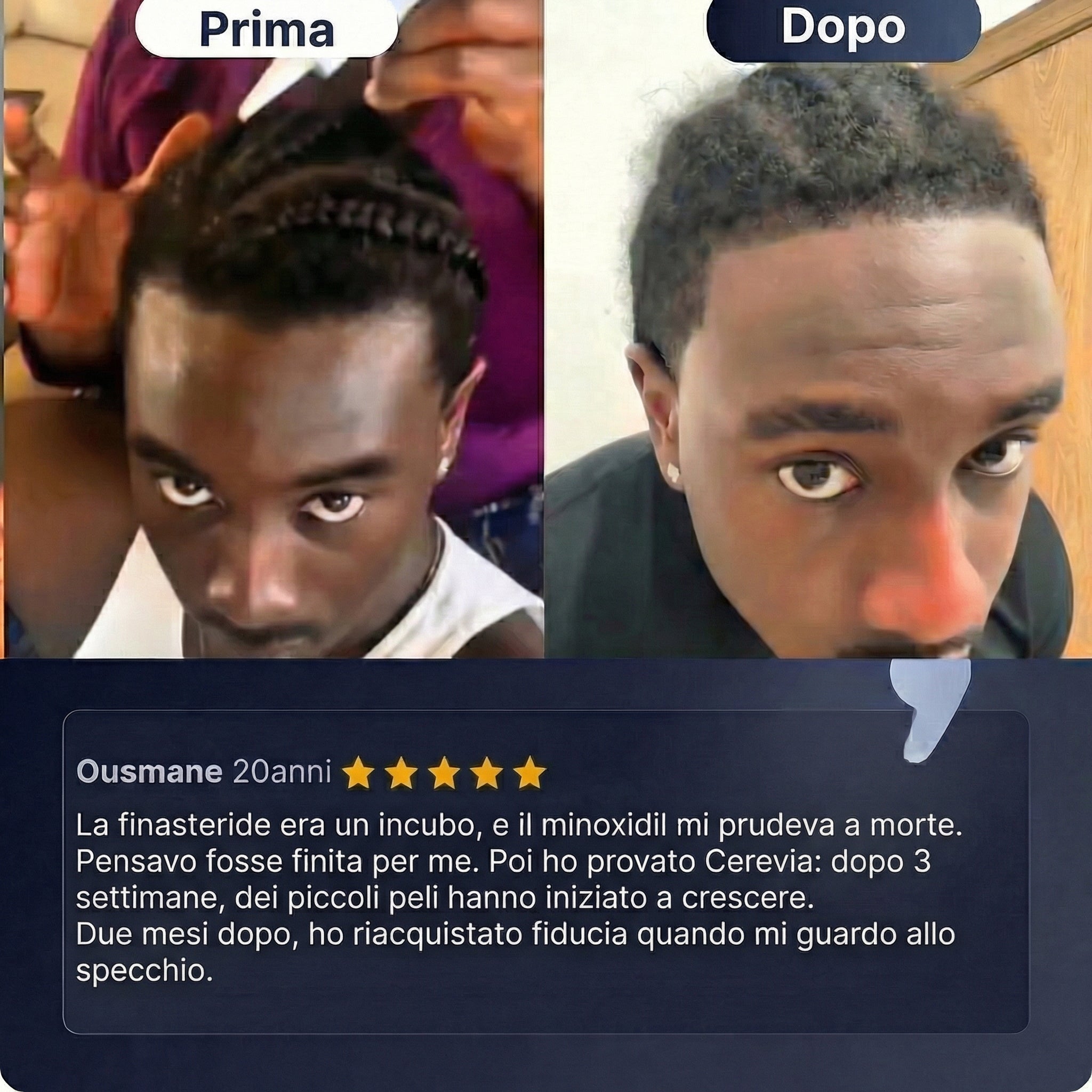 Cerevia - Siero ricrescita capelli